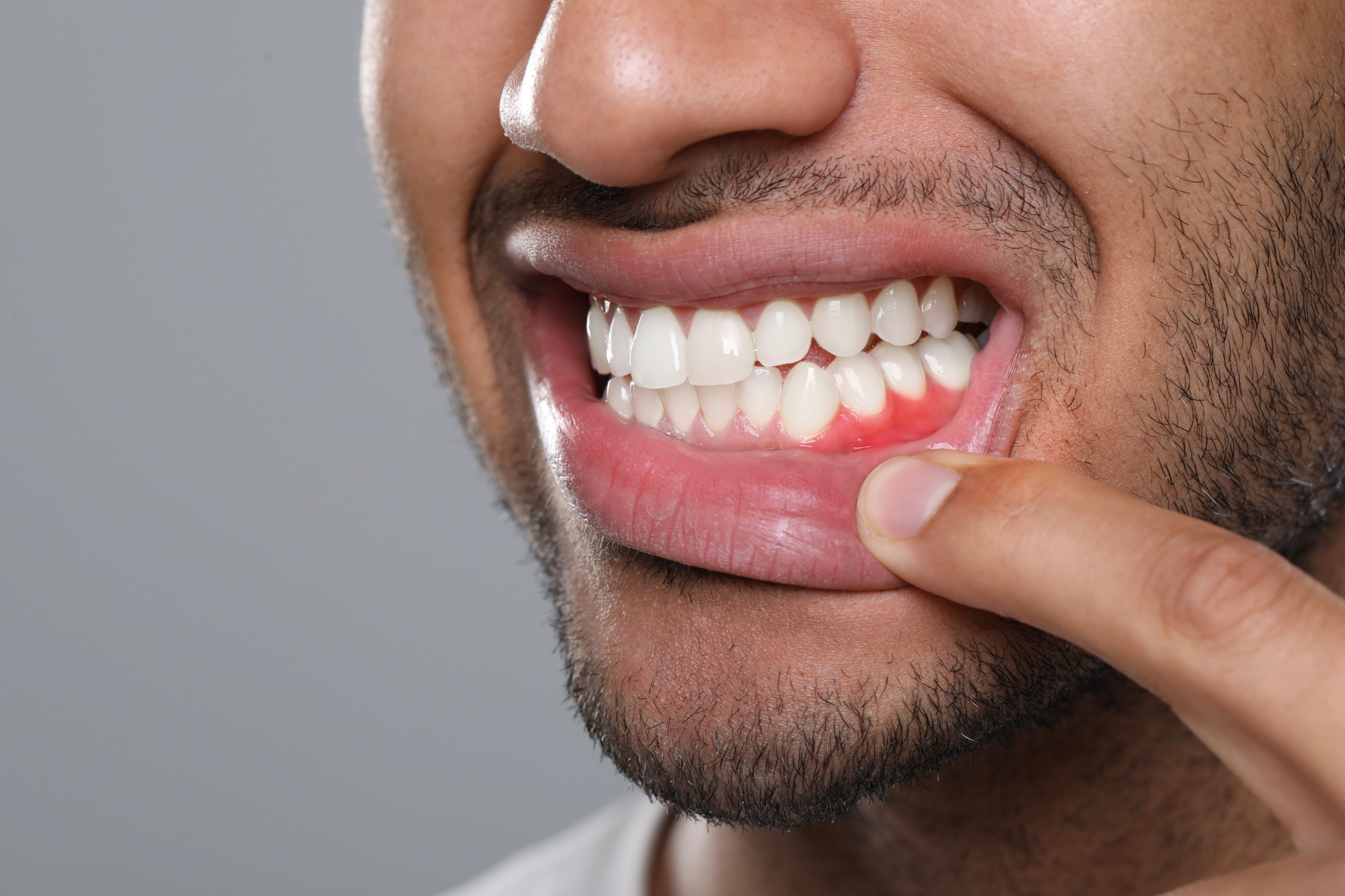 Treatments for Gum Disease